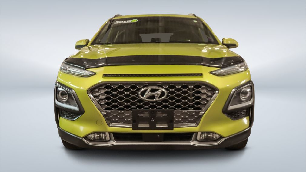 2018 Hyundai Kona — photo 2
