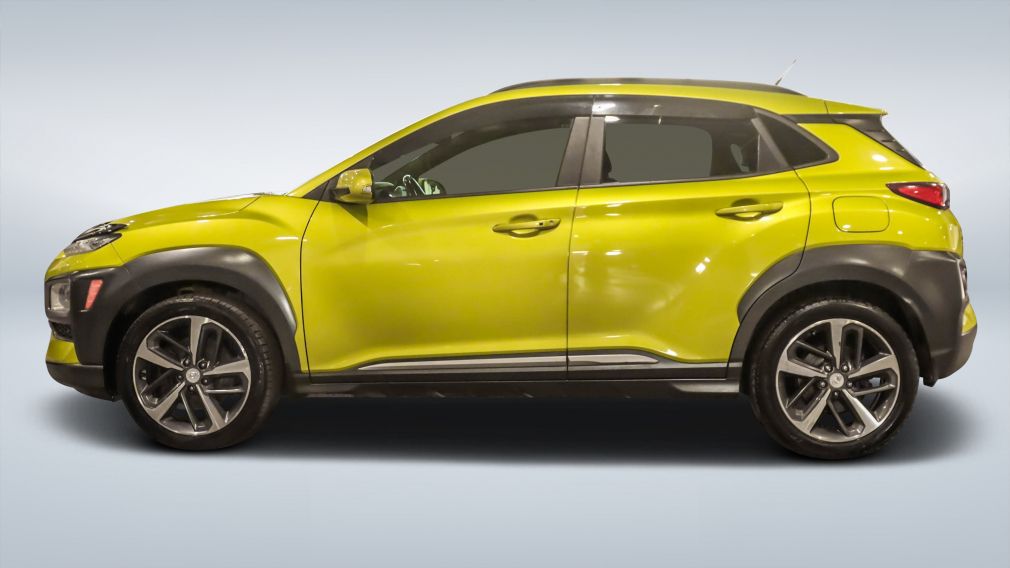 2018 Hyundai Kona — photo 4