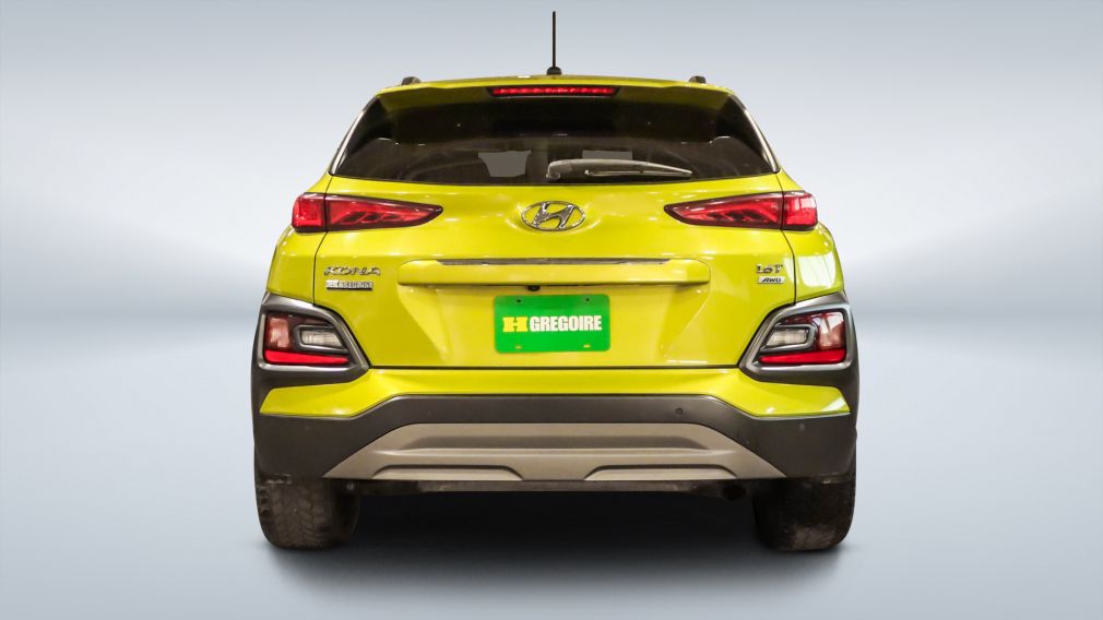 2018 Hyundai Kona — photo 6