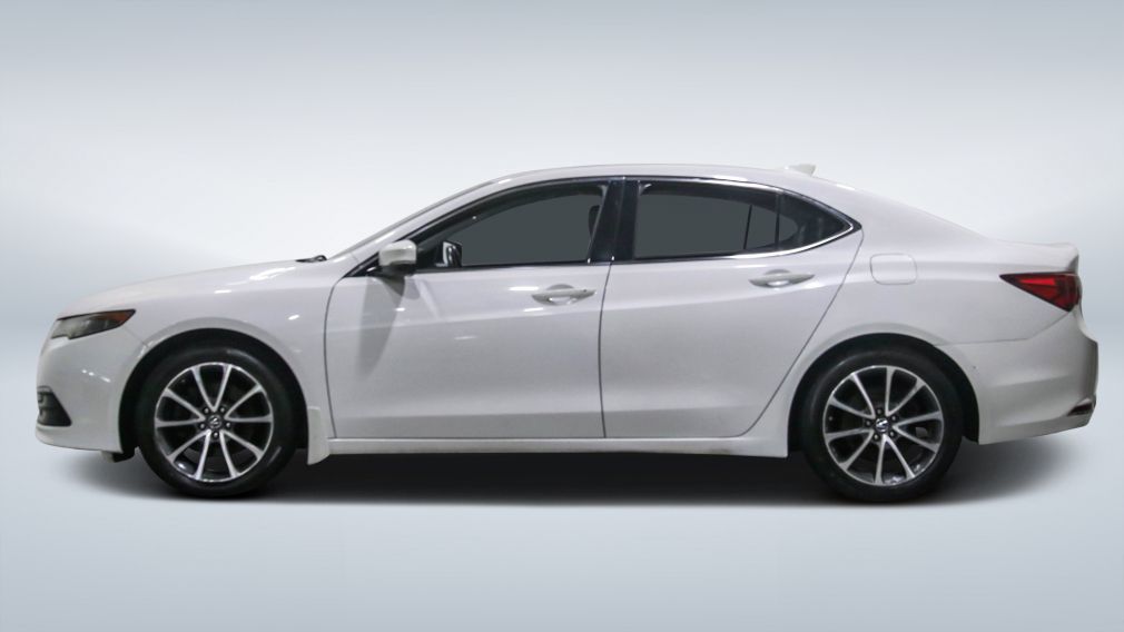 2016 Acura TLX — photo 4