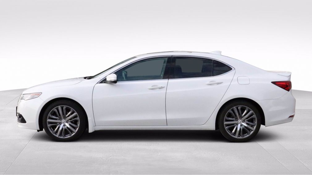 2015 Acura TLX TLX V6 Elite AWD #4