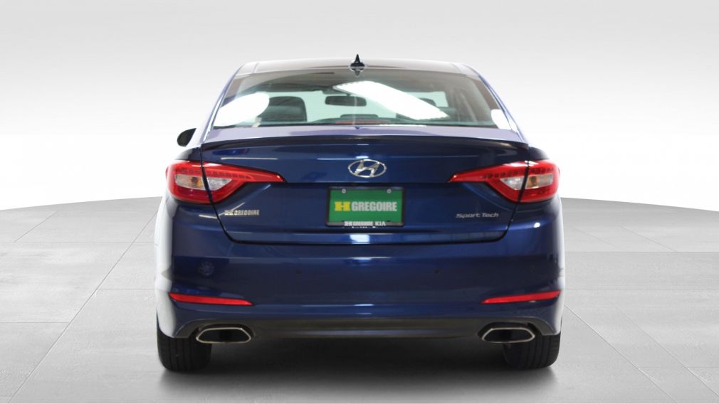 2017 Hyundai Sonata 2.4L Sport Tech #6